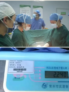 【第醫(yī)線(xiàn)】她“懷”了18年的“怪胎” 終于在這一天“分娩”了！